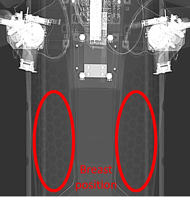 Immobilization board 2